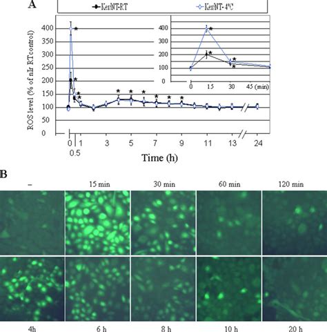 Kinetic Analysis Of Intracellular Ros Level Following Uvb Irradiation