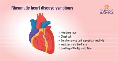 Rheumatic Fever Acute Rheumatic Fever Or Arf Symptoms Causes