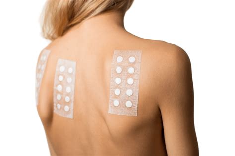 Exame De Alergia Teste De Contato Patch Test Cl Nica Suganuma