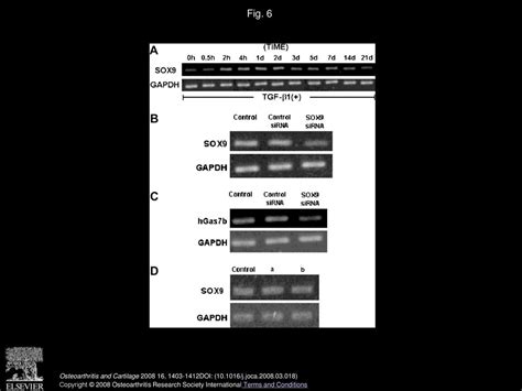 Involvement of Gas7 along the ERK1/2 MAP kinase and SOX9 pathway in ... 