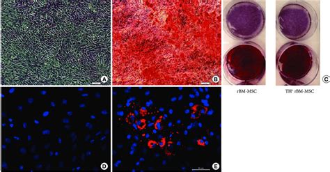 Differentiation Of Th Rbm Mscs Into Osteogenic A C And Adipogenic