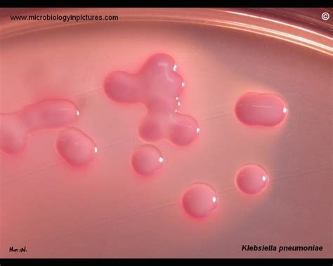 Klebsiella Pneumoniae On Macconkey Agar