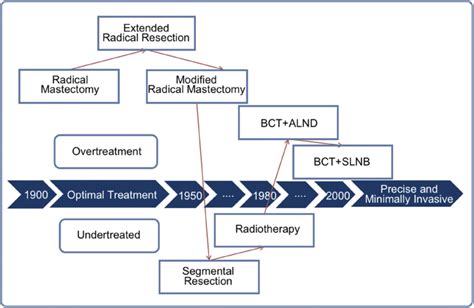 Timeline In The Evolution Of Breast Cancer Surgery Local Surgery For