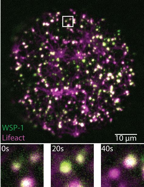 Researchers find the cell cortex is activated by thousands of short-lived protein condensates