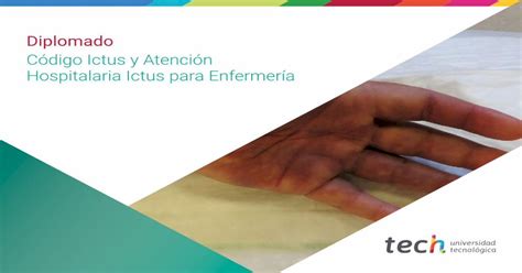 Código Ictus Y Atención Hospitalaria Ictus Para Enfermería Pdf Document