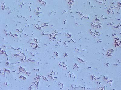 Pseudomonas Aeruginosa Gram Stain