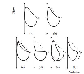 C2.3 Spirometry | COPD-X