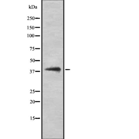 Hla Class I Polyclonal Antibody Invitrogen™ 100 μl Unconjugated Ver