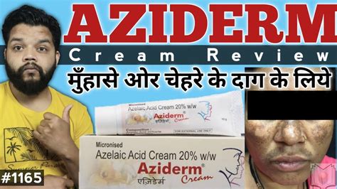 Aziderm 20 Cream Review Cream For Melasma And Acne Youtube