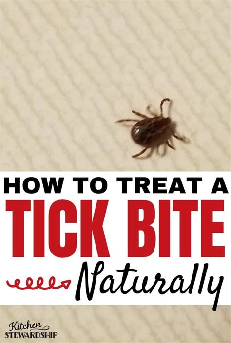 How To Treat A Tick Bite Naturally Tick Bite Holistic Remedies Ticks