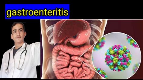 Gastroenteritis Youtube