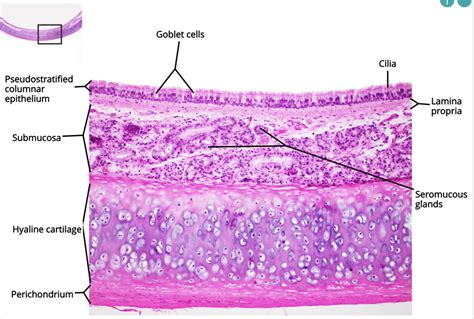 Ap Ii Lab Trachea Diagram Quizlet Hot Sex Picture