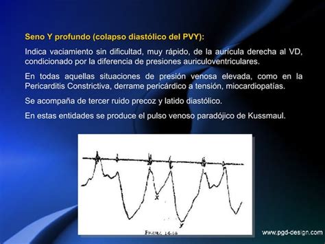 Pulso Venoso Yugular PPT