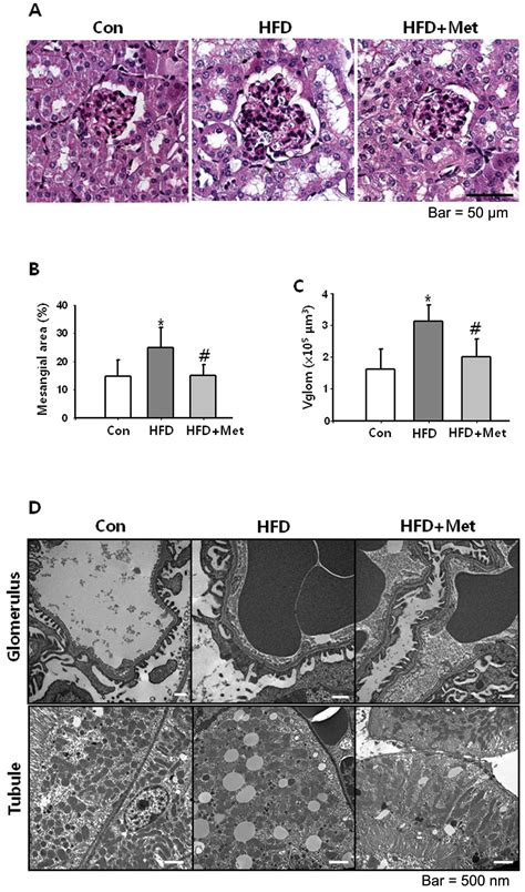 Metformin Decreases High Fat Diet Induced Renal Injury By Regulating