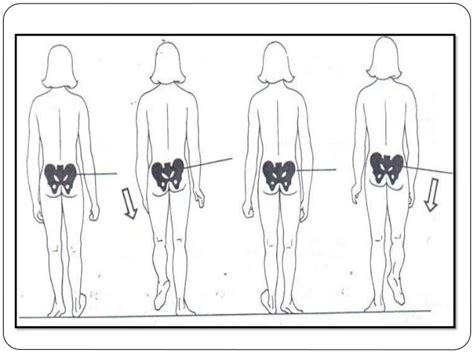 Biomecanica De La Marcha