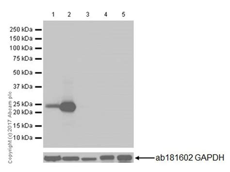 Anti Prolactin PRL Antibody EPR18018 31 Ab188229 Abcam