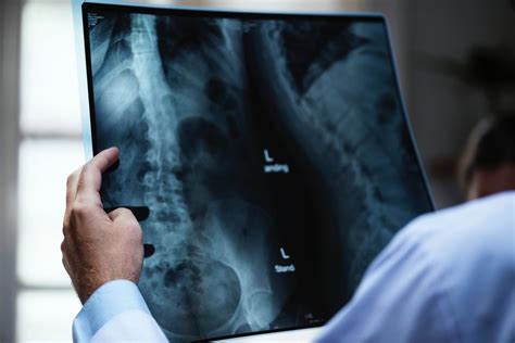 Intelligent Implants Raises 8 7m To Improve Its Spinal Fusion Surgery — Appedus