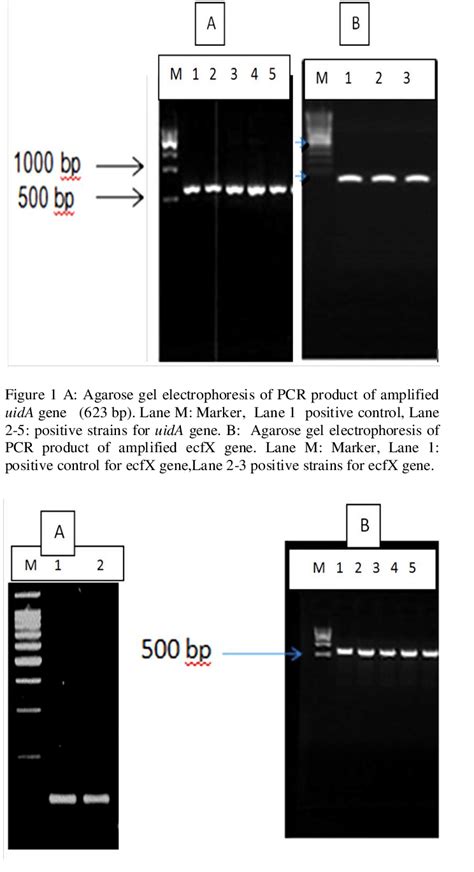 A Agarose Gel Electrophoresis Of Amplified Pcr Product Of Oxa 51 Gene