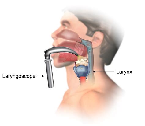 Laryngoscopy Ken Chad Consulting Ltd