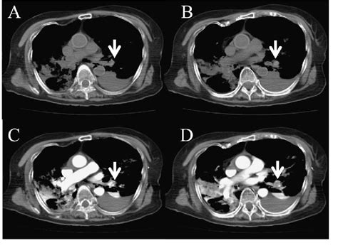 Figure From Post Mortem Contrast Enhanced Computed Tomography In A