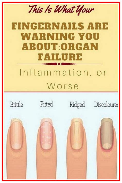 8 Important Signs Your Fingernails Can Tell About Your Health Artofit