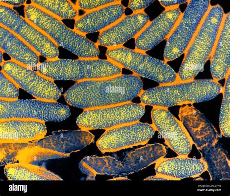 False Colour Transmission Electron Micrograph Of A Colony Of The Gram