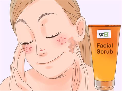 How To Get Rid Of Redness On Your Face Without Makeup Mugeek Vidalondon