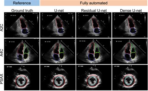 Representative Segmentation Results Of Fully Automated Methods Download Scientific Diagram