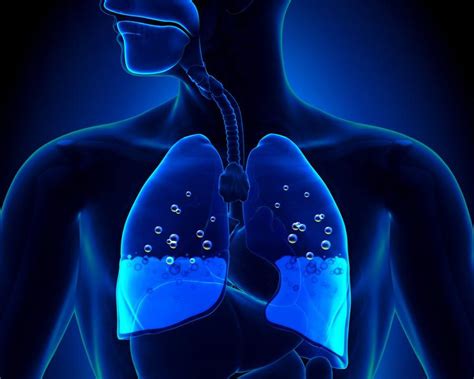 Cardiogenic Pulmonary Edema caused by Left Heart Failure