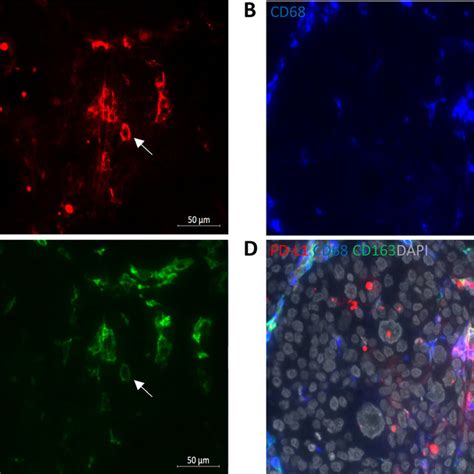 Pd L1 Positive Stromal Cells Are Primarily Cd68 Cd163 Macrophages Download Scientific