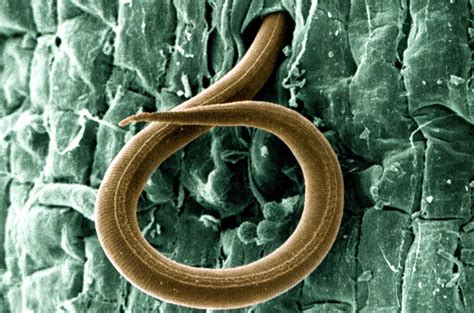 Parasitic Worms In Humans