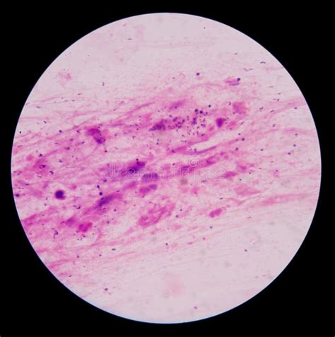 Esame Della Colorazione Di Gram Che Prova A Batteri Le Cellule