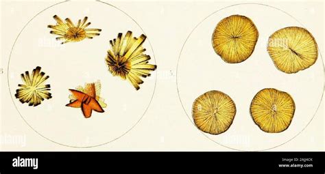 Bilirubin Crystal In Urine