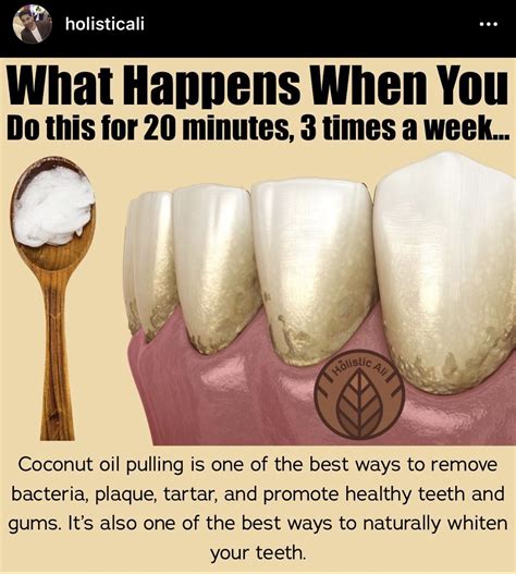 Pin By Nicky Pick On Holistic Health Coconut Oil Pulling Teeth