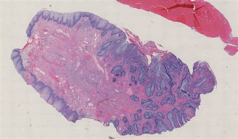 Pathology Outlines Case 256