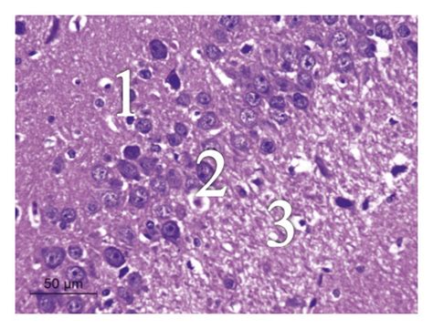 Photomicrograph of hippocampus of different experimental groups ...