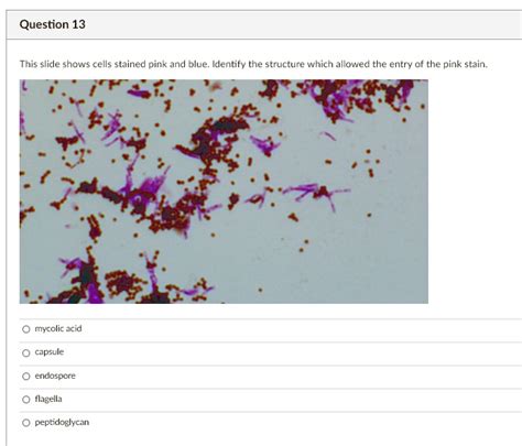 SOLVED This Slice Shows Cells Stained Pink And Blue Identify The