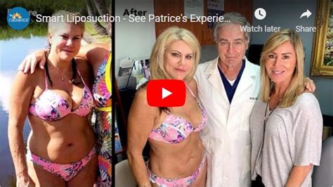 Smart Lipo In Boca Raton Laser Assisted Liposuction Minimally Invasive