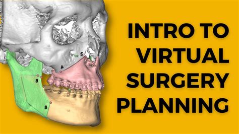 Introduction To Virtual Surgery Planning Youtube