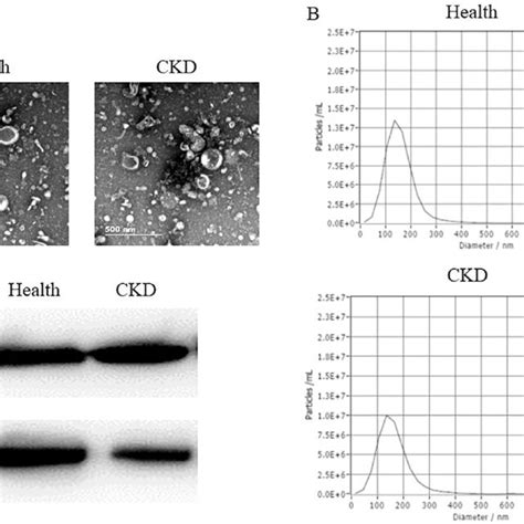 Urinary Exosomes Identification A Tem Image Of Exosomes From Healthy