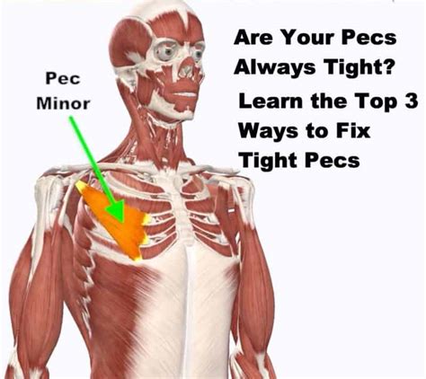 Tight Pec Minor - The Doctors Of Physical Therapy