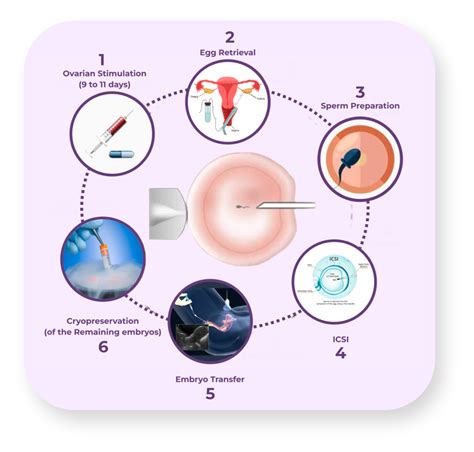 Intra Cytoplasmic Sperm Injection ICSI Aansh Ivf Hospital