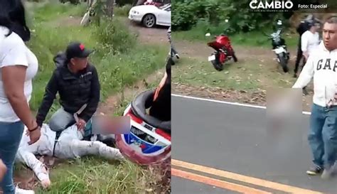 FUERTE VIDEO Motociclista Pierde Su Pie Por Manejar A Exceso De Velocidad