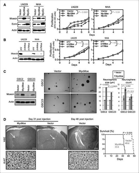 Moesin Is A Glioma Progression Marker That Induces Proliferation And