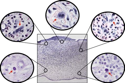 Acanthamoeba Histology