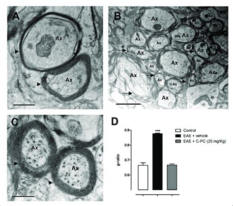 C PC Induced Remyelination In An EAE Model In Lewis Rats Panels Show