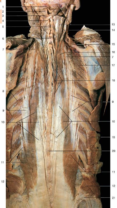 Intrinsic Back Muscles Cadaver Anatomy Diagram Quizlet