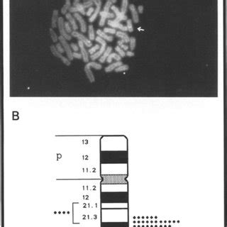 Chromosomal Localization Of The Human Dlx Genomic Locus A