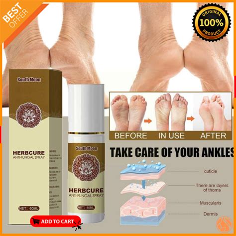 SOUTH MOON Herbcure Anti Fungal Spray Para Sa PAA 60ml FOOT Lazada PH