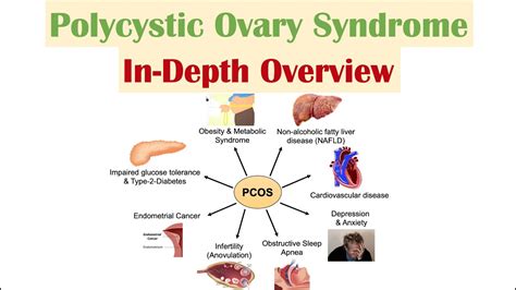 Polycystic Ovary Syndrome Pcos Overview Of Associated Conditions